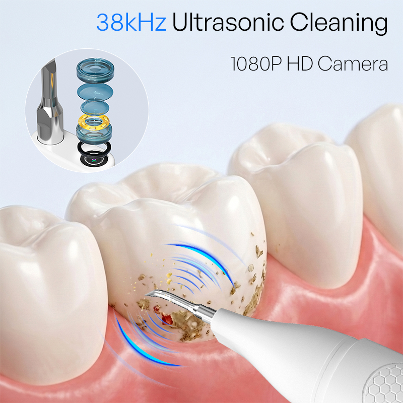 Limpiador Dental Ultrasónico V - Teeth Whitening Mouthwash reseña y precio